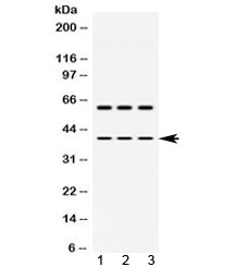 Western blot testing of 1) rat brain, 2) mouse brain and 3) human HepG2 lysate with ADH5 antibody at 0.5ug/ml. Predicted molecular weight ~40 kDa.