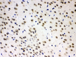 IHC testing of FFPE rat brain with AZIN2 antibody at 1ug/ml. HIER: steam sections in pH6 citrate buffer.