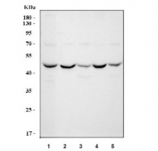 Western blot testing of 1) human HepG2, 2) rat brain, 3) rat liver, 4) mouse brain and 5) mouse liver tissue lysate with ABAT antibody.  Predicted molecular weight ~54 kDa.