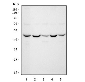 Western blot testing of 1) human HepG2, 2) rat brain, 3) rat liver, 4) mouse brain and 5) mouse liver tissue lysate with ABAT antibody.  Predicted molecular weight ~54 kDa.