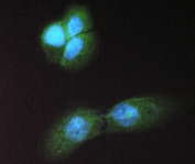 IF/ICC staining of FFPE human A431 cells with ABHD5 antibody (green) at 2ug/ml and DAPI nuclear stain (blue). HIER: steam sections in pH6 citrate buffer for 20 min.