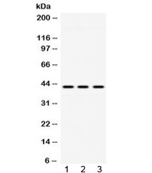 Western blot testing of 1) rat lung, 2) mouse brain and 3) human HeLa lysate with ACAA2 antibody at 0.5ug/ml. Predicted molecular weight ~42 kDa.