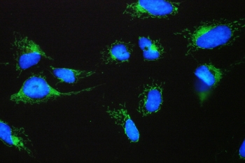 IF/ICC staining of FFPE human U-2 OS cells with ACAA2 antibody (green) at 2ug/ml and DAPI nuclear stain (blue). HIER: steam section in pH6 citrate buffer for 20 min.