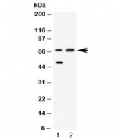 Western blot testing of 1) rat liver and 2) HeLa lysate with ACADVL antibody at 0.5ug/ml. Predicted molecular weight: 68-70 kDa.
