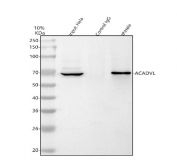 Immunoprecipitation of ACADVL protein from 500ug of human HeLa whole cell lysate with 2ug of ACADVL antibody.