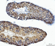 IHC testing of FFPE mouse testis tissue with ATP Citrate Lyase antibody at 2ug/ml. HIER: steam sections in pH8 EDTA for 20 min.