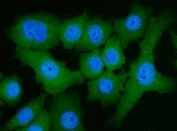 IF/ICC staining of FFPE human A549 cells with ATP Citrate Lyase antibody (red) at 5ug/ml and DAPI nuclear stain (blue). HIER: steam section in pH6 citrate buffer for 20 min.