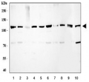 Western blot testing of human 1) A549, 2) MOLT4, 3) U-87 MG, 4) U-251, 5) 293T, 6) Hela, 7) T-47D, 8) HepG2, 9) rat pancreas and 10) mouse NIH 3T3 cell lysate with ATP Citrate Lyase antibody at 0.5ug/ml. Predicted molecular weight ~121 kDa.