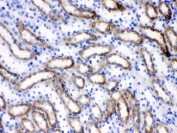 IHC testing of FFPE rat kidney tissue with ACSL1 antibody at 1ug/ml. HIER: steam sections in pH6 citrate buffer for 20 min.