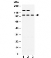 Western blot testing of 1) rat skeletal muscle, 2) mouse skeletal muscle and 3) human HT080 lysate with ACTN3 antibody at 0.5ug/ml. Predicted molecular weight ~103 kDa.