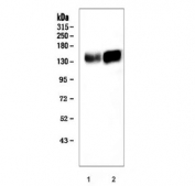 Western blot testing of 1) mouse liver and 2) rat brain tissue lysate with ADAMTS13 antibody. Predicted molecular weight ~154 kDa, may be observed at higher molecular weights due to glycosylation.