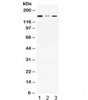 Western blot testing of 1) rat brain, 2) mouse liver and 3) human HepG2 lysate with ADAMTS13 antibody at 0.5ug/ml. Predicted/observed molecular weight ~154 kDa.
