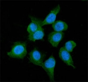 Immunofluorescent staining of FFPE human U-2 OS cells with Alcohol dehydrogenase antibody (green) and DAPI nuclear stain (blue). HIER: steam section in pH6 citrate buffer for 20 min.