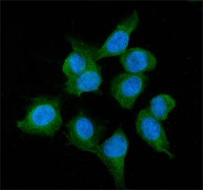 Immunofluorescent staining of FFPE human U-2 OS cells with Alcohol dehydrogenase antibody (green) and DAPI nuclear stain (blue). HIER: steam section in pH6 citrate buffer for 20 min.