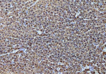 IHC testing of FFPE rat liver tissue with Alcohol dehydrogenase antibody. HIER: steam sections in pH8 EDTA buffer for 20 min.