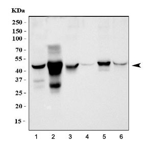 Western blot testing of 1) human HCCT, 2) human HCCP, 3) rat liver, 4) rat kidney, 5) mouse liver and 6) mouse kidney lysate with Alcohol dehydrogenase antibody at 0.5ug/ml. Predicted molecular weight ~40 kDa.