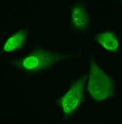 Immunofluorescent staining of FFPE human PC-3 cells with ADK antibody. HIER: steam section in pH6 citrate buffer for 20 min.