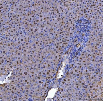 IHC staining of FFPE mouse liver tissue with ADK antibody. HIER: boil tissue sections in pH8 EDTA for 20 min and allow to cool before testing.