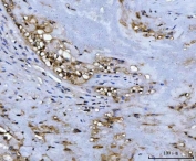 IHC staining of FFPE human placenta tissue with ADK antibody. HIER: boil tissue sections in pH8 EDTA for 20 min and allow to cool before testing.