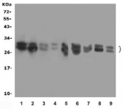 Western blot testing of 1) rat brain, 2) rat testis, 3) rat spleen, 4) human MCF-7, 5) human SW620, 6) mouse spleen, 7) mouse heart, 8) mouse HEPA1-6 and 9) mouse SP2/0 lysate with ADO antibody at 0.5ug/ml. Predicted molecular weight ~28/30 kDa.