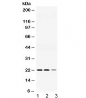 Western blot testing of 1) rat skeletal muscle, 2) mouse heart and 3) human COLO320 lysate with ADO antibody at 0.5ug/ml. Predicted molecular weight ~22 kDa.