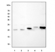 Western blot testing of 1) human HeLa, 2) human SiHa, 3) rat heart, 4) mouse lung and 5) mouse heart tissue lysate with AK1 antibody. Predicted molecular weight ~22 kDa.