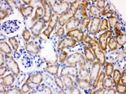 IHC testing of FFPE mouse kidney with AK2 antibody at 1ug/ml. HIER: steam sections in pH6 citrate buffer for 20 min.