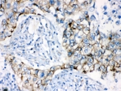 IHC testing of FFPE human lung with AK2 antibody at 1ug/ml. HIER: steam sections in pH6 citrate buffer for 20 min.