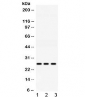 Western blot testing of 1) rat liver, 2) mouse kidney and 3) human HeLa lysate with AK2 antibody at 0.5ug/ml. Predicted molecular weight ~26 kDa.
