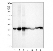 Western blot testing of 1) human HepG2, 2) human A549, 3) human HCCP, 4) rat liver, 5) rat kidney, 6) mouse liver and 7) mouse kidney lysate with AKR1C1/2 antibody. Predicted molecular weight ~37 kDa (AKR1C1) and ~37 kDa (AKR1C2).