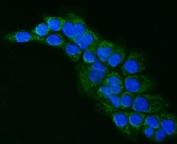 Immunofluorescent staining of FFPE human A431 cells with ALDH1B1 antibody (green) and DAPI nuclear stain (blue). HIER: steam section in pH6 citrate buffer for 20 min.