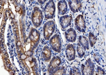 IHC staining of FFPE rat colon with ALDH1B1 antibody. HIER: boil tissue sections in pH8 EDTA for 20 min and allow to cool before testing.