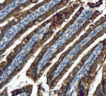 IHC staining of FFPE mouse colon with ALDH1B1 antibody. HIER: boil tissue sections in pH8 EDTA for 20 min and allow to cool before testing.