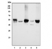 Western blot testing of 1) rat liver, 2) rat testis, 3) rat RH35, 4) mouse brain and 5) mouse liver tissue lysate with ALDH1B1 antibody. Predicted molecular weight ~57 kDa.