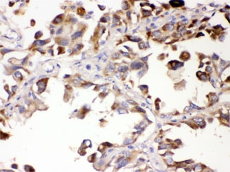 IHC testing of FFPE human lung with ALDH7A1 antibody at 1ug/ml. HIER: steam sections in pH6 citrate buffer for 20 min.