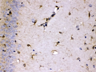 IHC testing of FFPE rat brain with ALDH7A1 antibody at 1ug/ml. HIER: steam sections in pH6 citrate buffer for 20 min.