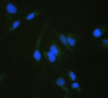 IF/ICC staining of FFPE human U-2 OS cells with ALDH7A1 antibody (green) at 2ug/ml and DAPI nuclear stain (blue). HIER: steam section in pH6 citrate buffer for 20 min.