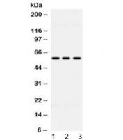 Western blot testing of 1) rat liver, 2) mouse HEPA and 3) human HeLa lysate with ALDH7A1 antibody at 0.5ug/ml. Predicted molecular weight ~58 kDa.