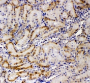 IHC staining of FFPE rat kidney with GP78 antibody. HIER: boil tissue sections in pH6, 10mM citrate buffer, for 20 min and allow to cool before testing.