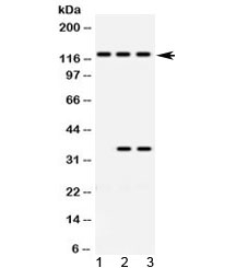 Western blot testing of 1) rat brain, 2) human HeLa and 3) human Jurkat lysate with ARHGEF1 antibody at 0.5ug/ml. Predicted molecular weight ~102 kDa, but routinely observed at ~115 kDa.