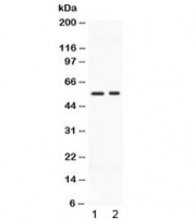 Western blot testing of human 1) HeLa and 2) MCF7 cell lysate with BMP15 antibody at 0.5ug/ml. Routinely observed molecular weight: ~50 kDa pro form and 16-17 kDa mature form.
