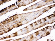 IHC testing of FFPE rat skeletal muscle with CA3 antibody at 1ug/ml. HIER: steam section in pH6 citrate buffer for 20 min.