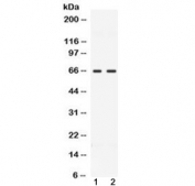 Western blot testing of 1) rat testis and 2) human MCF7 lysate with CCDC6 antibody at 0.5ug/ml. Predicted molecular weight ~53 kDa, routinely observed at ~65 kDa.