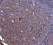 IHC staining of FFPE human tonsil tissue with CD40 antibody. HIER: boil tissue sections in pH8 EDTA for 20 min and allow to cool before testing.
