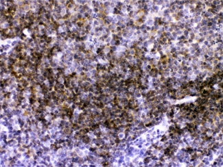 IHC testing of FFPE mouse spleen with CD40 antibody at 1ug/ml. HIER: steam section in pH6 citrate buffer for 20 min.