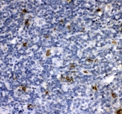 Western blot testing of human 1) COLO320, 2) MCF7 and 3) U-2 OS lysate with Cathepsin G antibody at 0.5ug/ml. Predicted molecular weight ~29 kDa, can be observed at ~36 kDa.