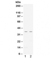 Western blot testing of human 1) CEM and 2) A549 lysate with CXCL16 antibody at 0.5ug/ml. Predicted molecular weight ~29 kDa, glycosylated form ~60 kDa, cleaved glycosylated form ~35 kDa.
