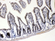IHC testing of FFPE mouse intestine with E2F4 antibody at 1ug/ml. HIER: steam section in pH6 citrate buffer for 20 min.