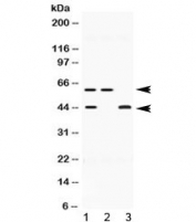 Western blot testing of human 1) HeLa, 2) U-2 OS and 3) MCF7 lysate with E2F4 antibody at 0.5ug/ml. Expected molecular weight ~44 kDa (unmodified) and 60-65 kDa (phosphorylated).