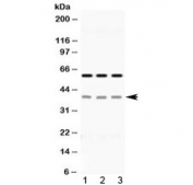 Western blot testing of human 1) HeLa, 2) A549 and 3) PANC-1 cell lysate with EpCAM antibody at 0.5ug/ml. Expected molecualr weight: 35/40-42 kDa (unmodified/glycosylated).